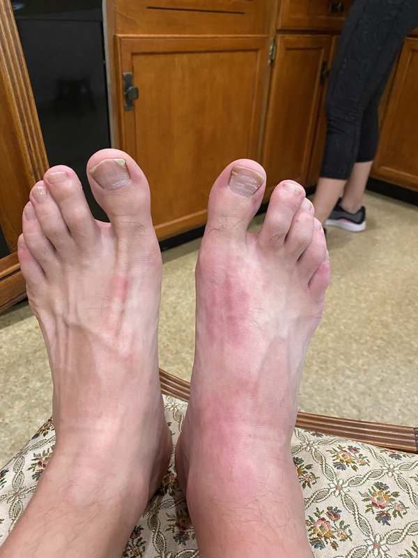 Feet Aftermath 1
